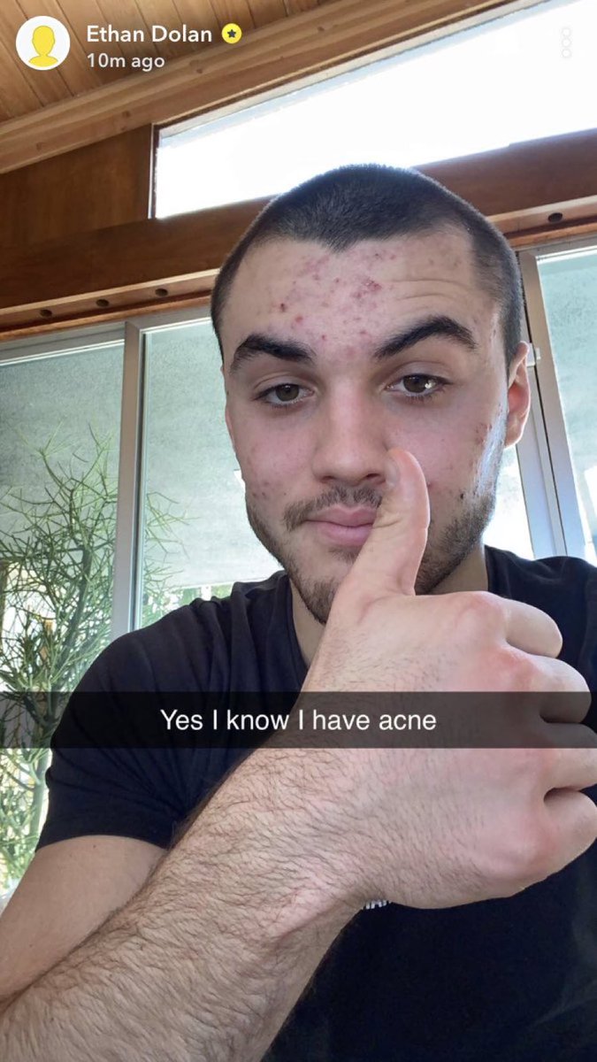 STARRYDOLANN's tweet photo. WHO TF CALLING HIM UGLY I WANT TO TALK LIKE SHUT UP HE IS PERFECT https://t.co/bRsBhg8TSb