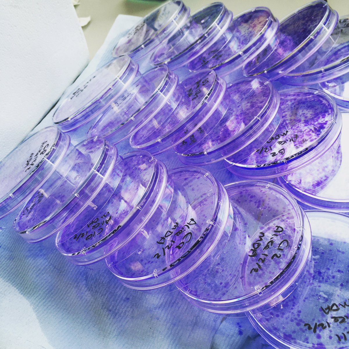 aliceaoc's tweet photo. A month of work paying off this week - and enjoying the pretty results! 😍💜💪🏻👩🏼‍🔬 #PhDlife #prettyscience #stainingthelab #lookatthecells #cancerresearch #womeninscience https://t.co/TXZmBC0UBR