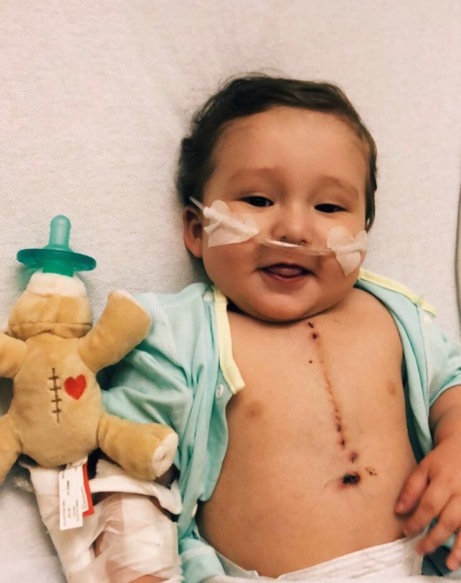 WubbaNub's tweet photo. According to Project Heart (@PROJHEART ), #CHD is the world’s most common birth defect, affecting 1.35 million infants every year worldwide.💕 #CHDAware ➡️ https://t.co/uYfHlU0dbT

📸 Insta/ell_322

#WubCares #CHDWarrior #CHDAwareness  #1in100 #HeartMonth #HeartWarrior #CureCHD https://t.co/pPIKs0QVFZ