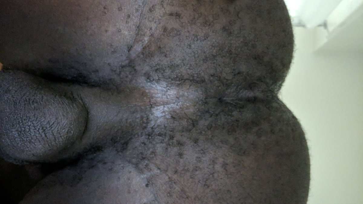 RedBushHunter's tweet photo. My furry hole. #HairyHole #HairyBlkHole #RedBushHunter https://t.co/BXXEbIE1O8