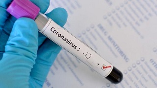 Coronavirus: six steps to prepare your organisation for a pandemic ow.ly/vD1G30ql3lO by @sbalaouras via @HRZone #coronavirus #HR #PandemicPlan #BusinessContinuity #covid19