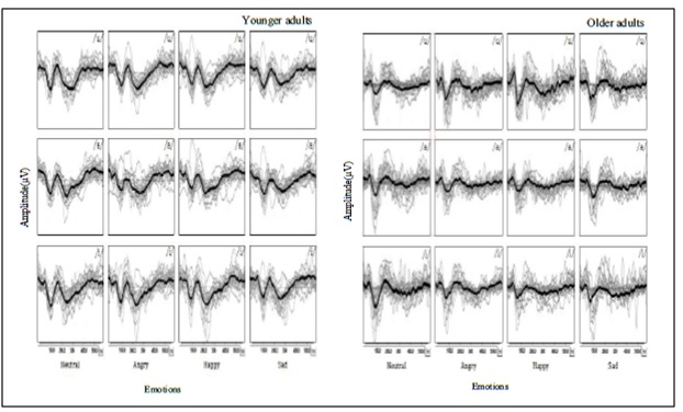 The Effects Of Age, Vowel, And Emotion For The #Cortical #Auditory Evoked Potentials
heraldopenaccess.us/openaccess/the…