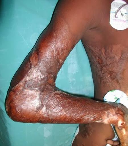 LionBahari's tweet photo. THIS IS TO INFORM ALL THAT OUR ANNUAL PLASTIC AND RECONSTRUCTIVE SURGERY CAMP WILL BE HELD AT THE END OF MAY 2020 AT TAWFIQ HOSPITAL, MALINDI IN KILIFI COUNTY.

THIS CAMP IS TOTALLY FREE.

WATCH OUT FOR THE DATE. https://t.co/icCBV1RwOU