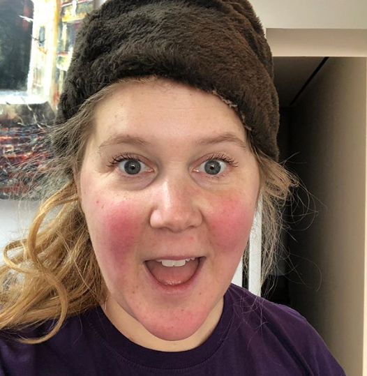 askDrCaperton's tweet photo. IVF can come with a rollercoaster of emotions, but it's important to know you're not https://t.co/S3UYsfv3P3's Amy Schumer's IVF update. https://t.co/XxtvJ8biQr https://t.co/yJrIFOgt2W