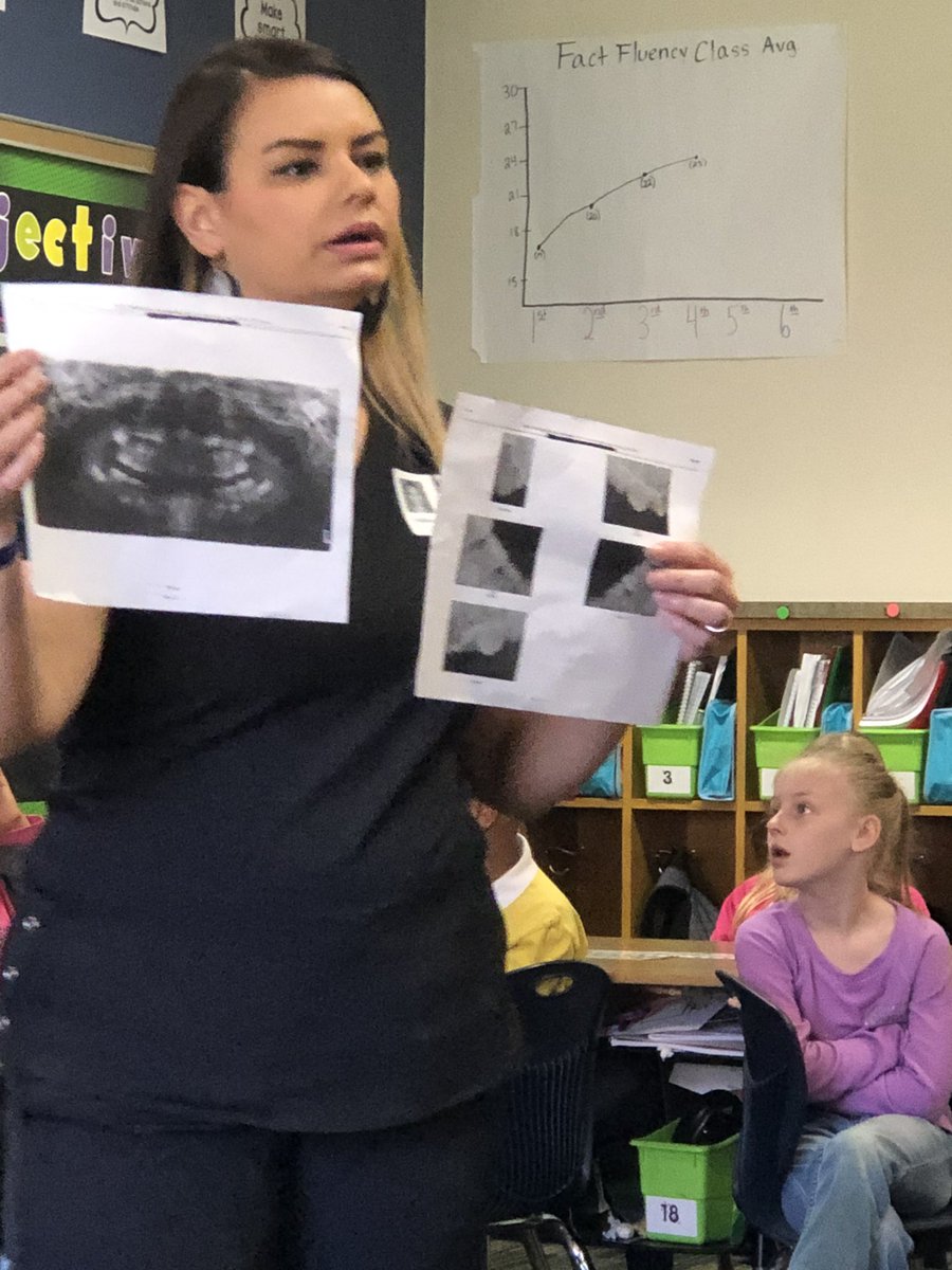 ChristinePyron's tweet photo. Station 3- learning about a dental hygienist ❤️ and she brought new toothbrushes for the kids🎉 @CastlemanCreek #ccecareerday https://t.co/tVBvqUPOGw