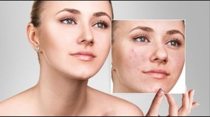 CitraMegaDewi1's tweet photo. INOVASI TEKNOLOGI
(GLOWING SKIN)

-A THREAD- https://t.co/pXXCh3XoDu