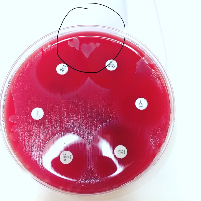 IBMScience's tweet photo. It's time to choose! Which entry will win our #LabHearts #IBMSCompetition? Will it be @ShirkieYvonne's red heart or Sajeda Patel's purple monocyte?
Cast your vote by commenting red or purple below. May the best heart win! https://t.co/WZnU2L3YBX