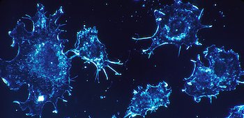 EuroCardioOnc's tweet image. ECOS is proud to support and facilitate the improvement of #CardiologyOncology knowledge and practice with our online #CMECPD courses. Check out the archived webcasts from #ECOS2019 and new #ImmunoOncology primers: bit.ly/32HbL4w #cardiology #oncology #MedEd