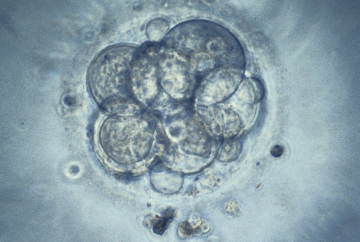 PET (@pet_bionews) on Twitter photo ‘PET is delighted to hear <a href="/MattHancock/">Matt Hancock</a> comments that CCGs should not deny #infertile couples NHS #IVF based on postcode. His words that commissioning of NHS #fertility services should be centralised with national standards are a victory for common sense.' bit.ly/399TGhF ‘PET is delighted to hear <a href="/MattHancock/">Matt Hancock</a> comments that CCGs should not deny #infertile couples NHS #IVF based on postcode. His words that commissioning of NHS #fertility services should be centralised with national standards are a victory for common sense.' bit.ly/399TGhF