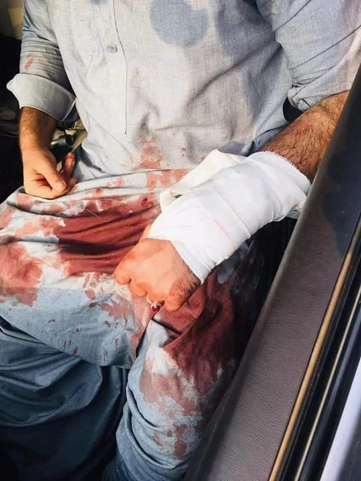 پنجاب یونیورسٹی میں بلوچ اور پشتون طلباء پر تشدد بلوچستان کے طلباء کے لئے تعلیم کے دروازے بند کرنے کے پالیسیوں کا تسلسل ہے.
#save4balochpashtoonstudents