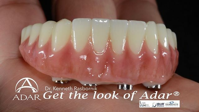 pinhasadar's tweet photo. Why settle for less? At $4,999 (for dentists only) your patients can have the best in esthetics, with no chipping or breaking and a 5-10 average seat time of the final zirconia! What are you waiting for? Call for an Adar Affiliate dentist near you today.… https://t.co/KXJ1jK4Mlc https://t.co/E3rSQcKJIA