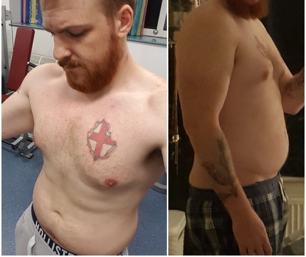 GreyJason2's tweet image. We talk about wanting a healthier lives for our patients, but if we don't practice what we preach, then who are we to give advise. Let's lead by example, let us show what feels is impossible is possible. Let's inspire and ignite determination for our service users. #elft