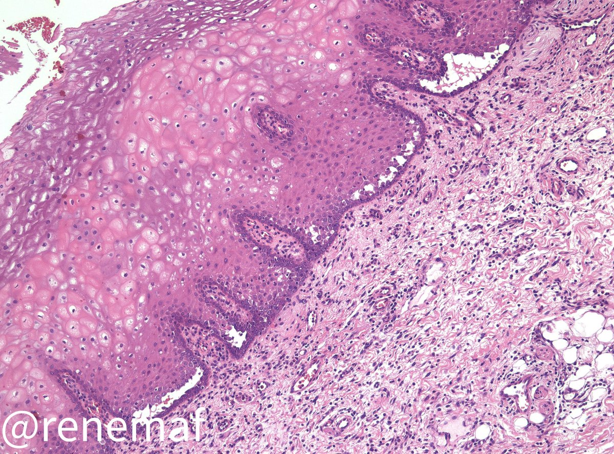 René Martínez Flores tweet media