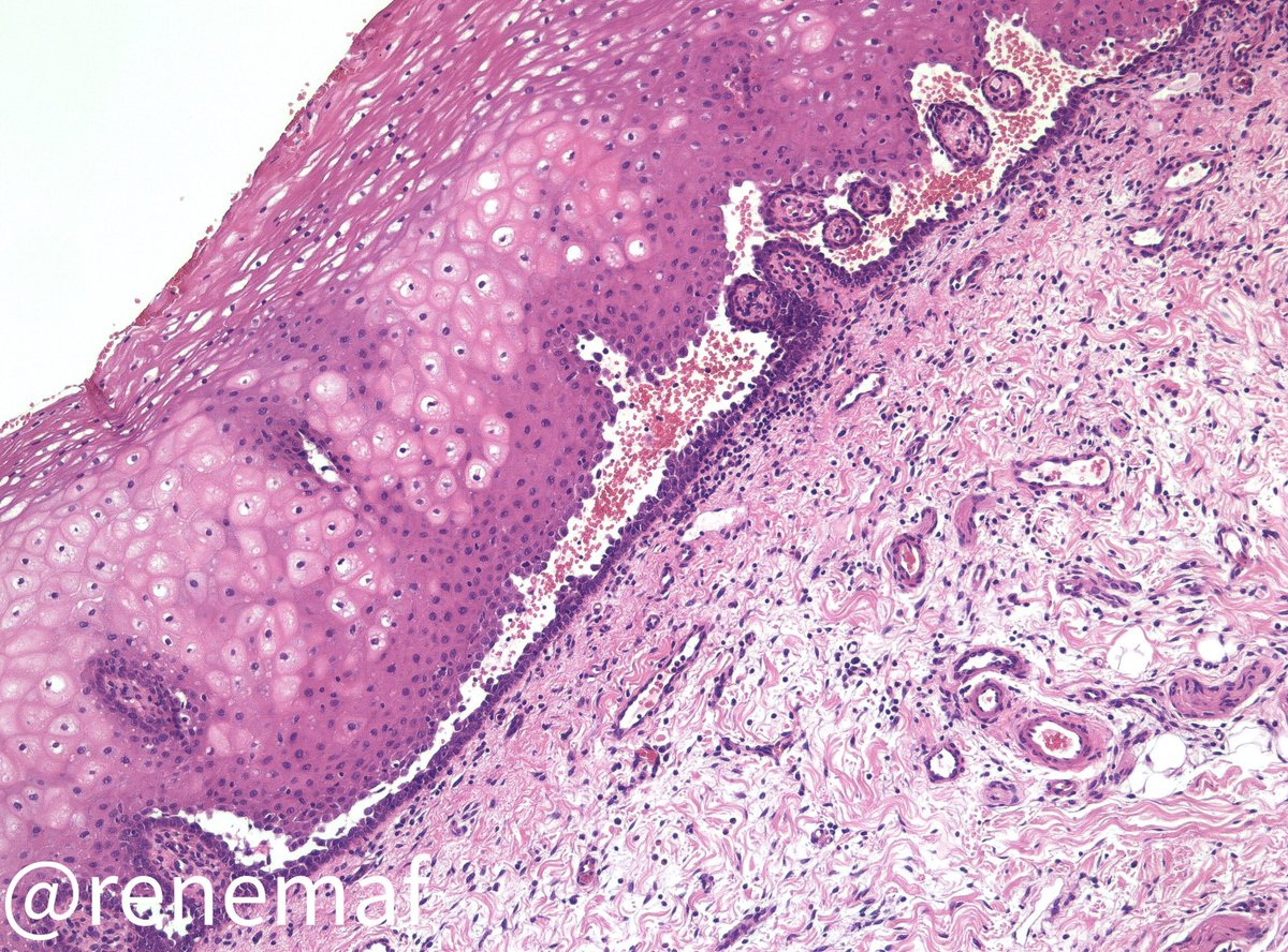 René Martínez Flores tweet media
