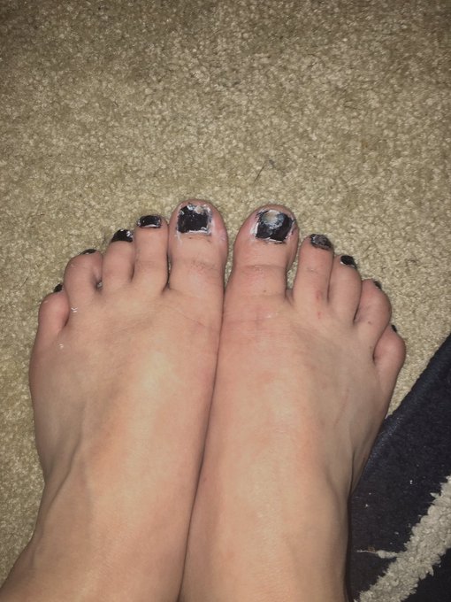 Please help my unfortunate problematic #feet. I need someone to paint my #toenails because I can&rsquo;t. #feetfreaks<a href="/tag/feet"class="tags">#feet</a><a href="/tag/toenails"class="tags"><span>#toenails</span></a><a href="/tag/feetfreaks"class="tags"><span>#feetfreaks</span></a><a href="/tag/feetoftwitter"class="tags"><span>#feetoftwitter</span></a>
