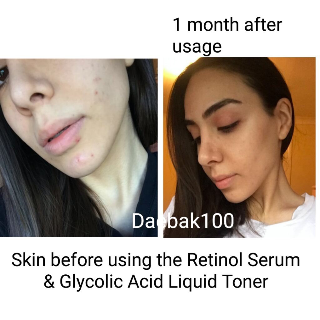 Download Umairaharis On Twitter Macam Biasa Glow Recipe Mesti La Tak Boleh Tinggal Ni Wajib Ada Siapa Tak Pernah Cuba Rugi La Bawah Ni Aku Ada Share Apa Yang Best Tentang Glow Recipe PSD Mockup Templates