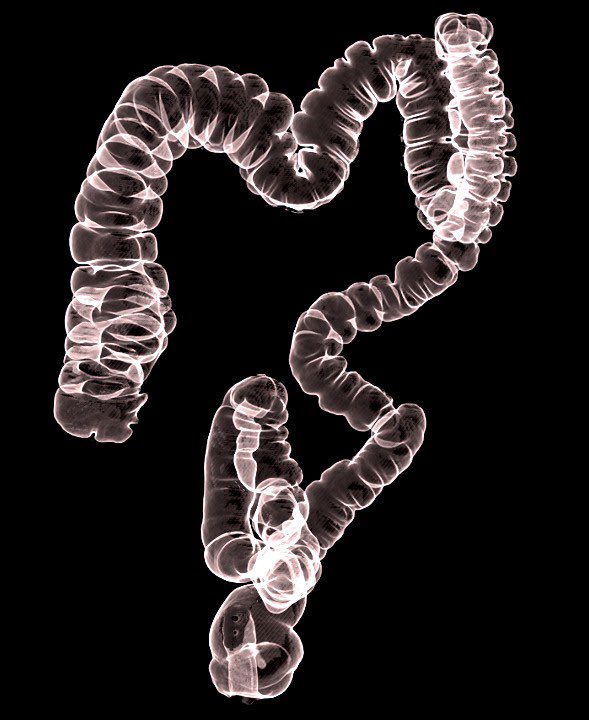 Подготовка пациента к компьютерной томографии. Кт-колонография прямой кишки. Компьютерно-томографическая колоноскопия. Как подготовиться к кт кишечника. Как подготовиться к кт кишечника.