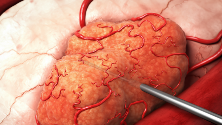 ESIsrael21c's tweet photo. Una avanzada #Tecnologia contra el #cancer desarrollada en #Israel por @AlphaTauMedical elimina el 70% de los #tumores con #radiacion Alfa. Un esfuerzo conjunto de  @uzisoferl CEO de la empresa y el prof. Yona Keisari de @TelAvivUni - ya da  resultados https://t.co/jeqh6Zxez9 https://t.co/qu6uXADfJd
