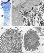 BrJDermatol's tweet image. This paper evaluates the use of #TransmissionElectronMicroscopy in the diagnosis of #Ehlers-Danlos Syndromes: ow.ly/TlD050ywzGv @TheEDSociety @rarediseaseday