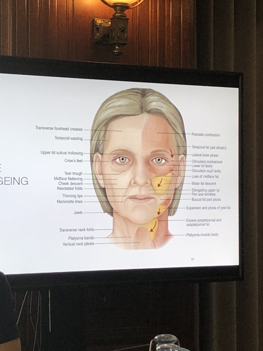 JaneLambertECG's tweet photo. Great morning. Learning #FacialAnatomy, #AgeingProcess and #complications in #aesthetics. #WalkTheWalk https://t.co/vOKwZ2SUdU