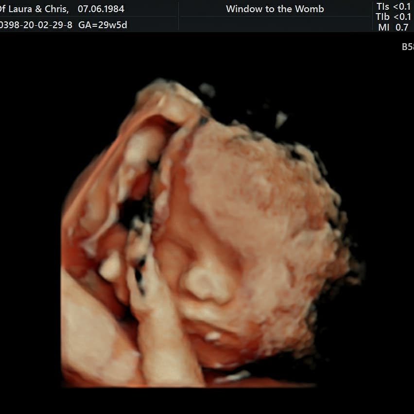 Paigemiasmum's tweet photo. #4dscan #hdscan https://t.co/L2kBcw9Z7X