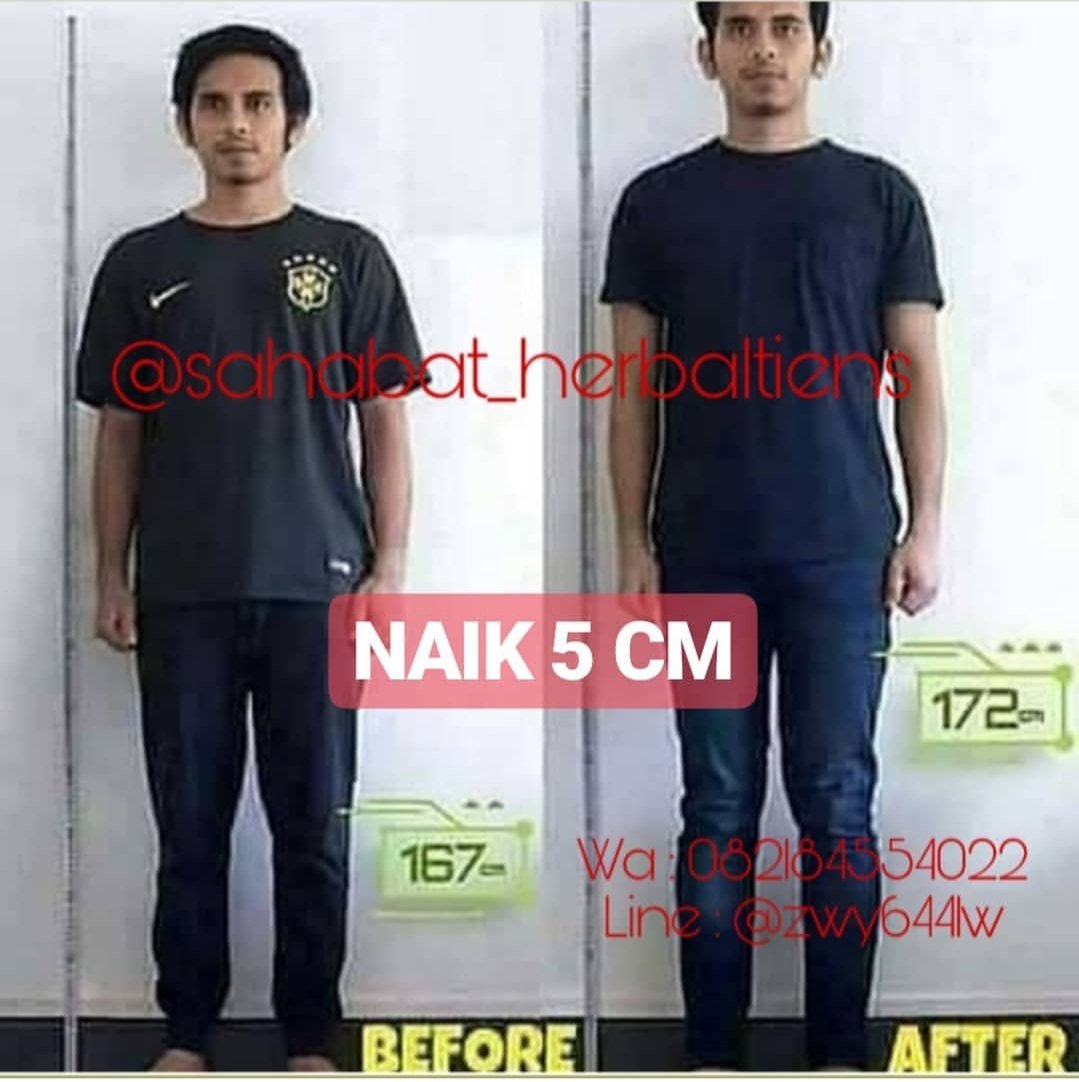 YonaPakarHerbal's tweet photo. Cari #peninggibadan yg Terbukti Menambah tinggi 2-8cm sebulan
Dg #kalsiumtiens #zinctiens
Chat wa Yoona 082184554022
#stokistienspalembang #tienspalembang
#peninggipalembang
#peninggibadanpalembsng https://t.co/jrHeMfnYcq