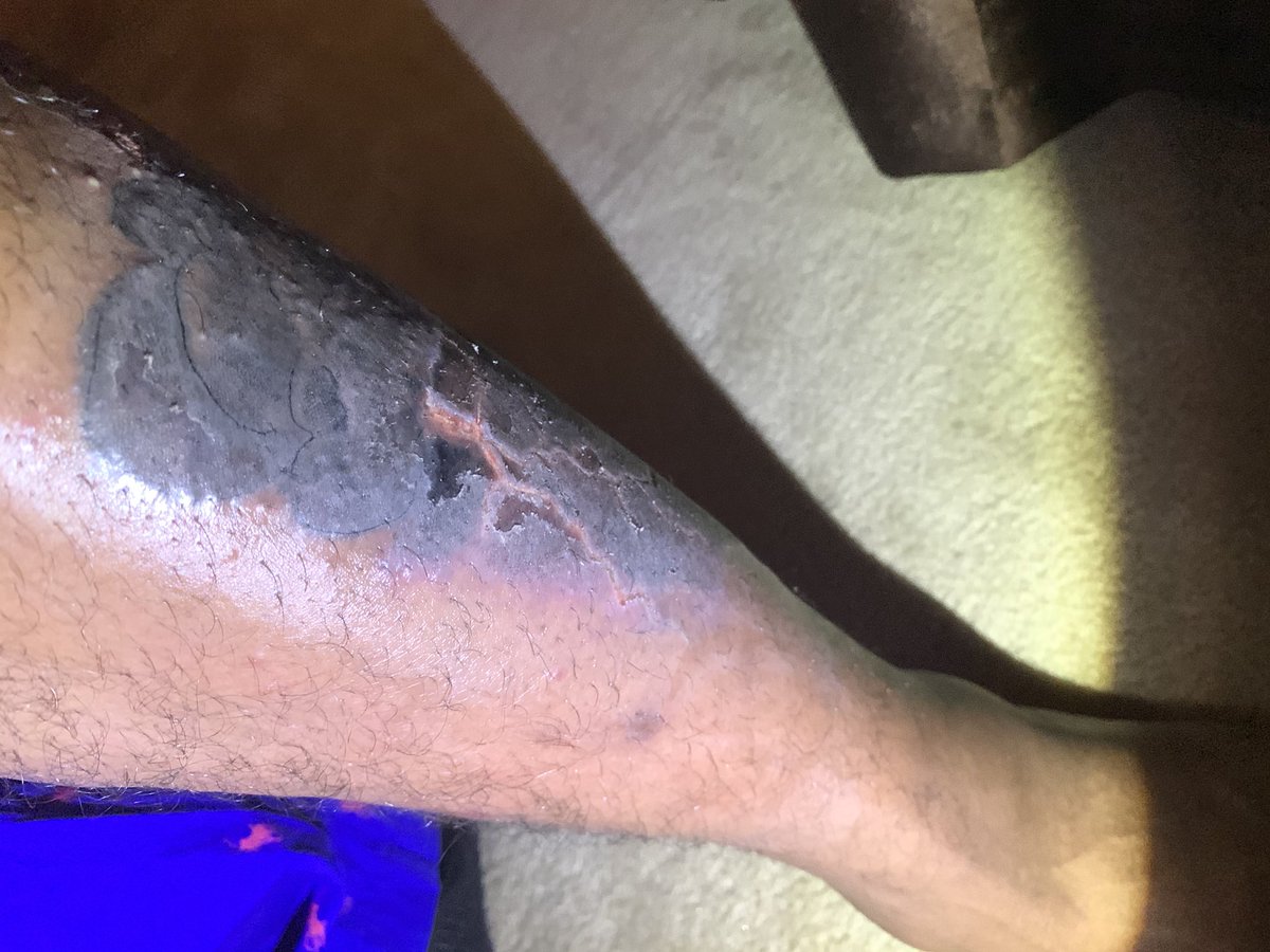 DaRealTDreams's tweet photo. Tattoo done by a female in Grambling....My shit look infected mane 😒 Tell me what y’all think!? https://t.co/ljFpo0VitW