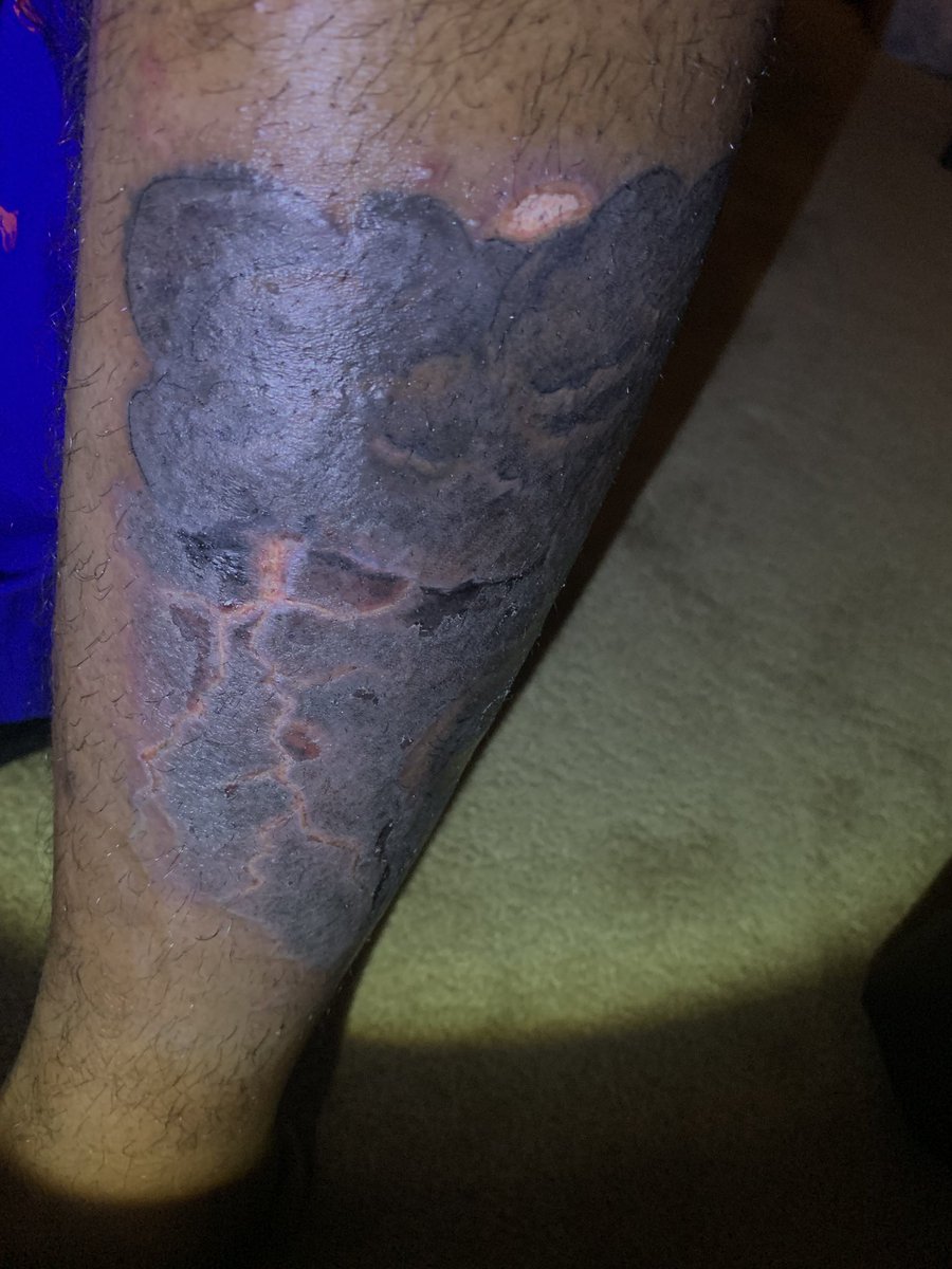 DaRealTDreams's tweet photo. Tattoo done by a female in Grambling....My shit look infected mane 😒 Tell me what y’all think!? https://t.co/ljFpo0VitW