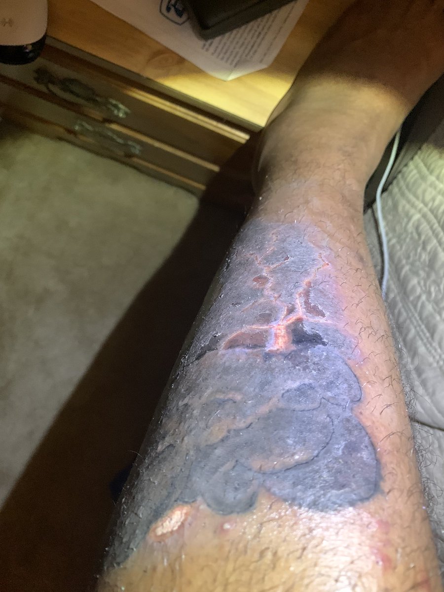 DaRealTDreams's tweet photo. Tattoo done by a female in Grambling....My shit look infected mane 😒 Tell me what y’all think!? https://t.co/ljFpo0VitW
