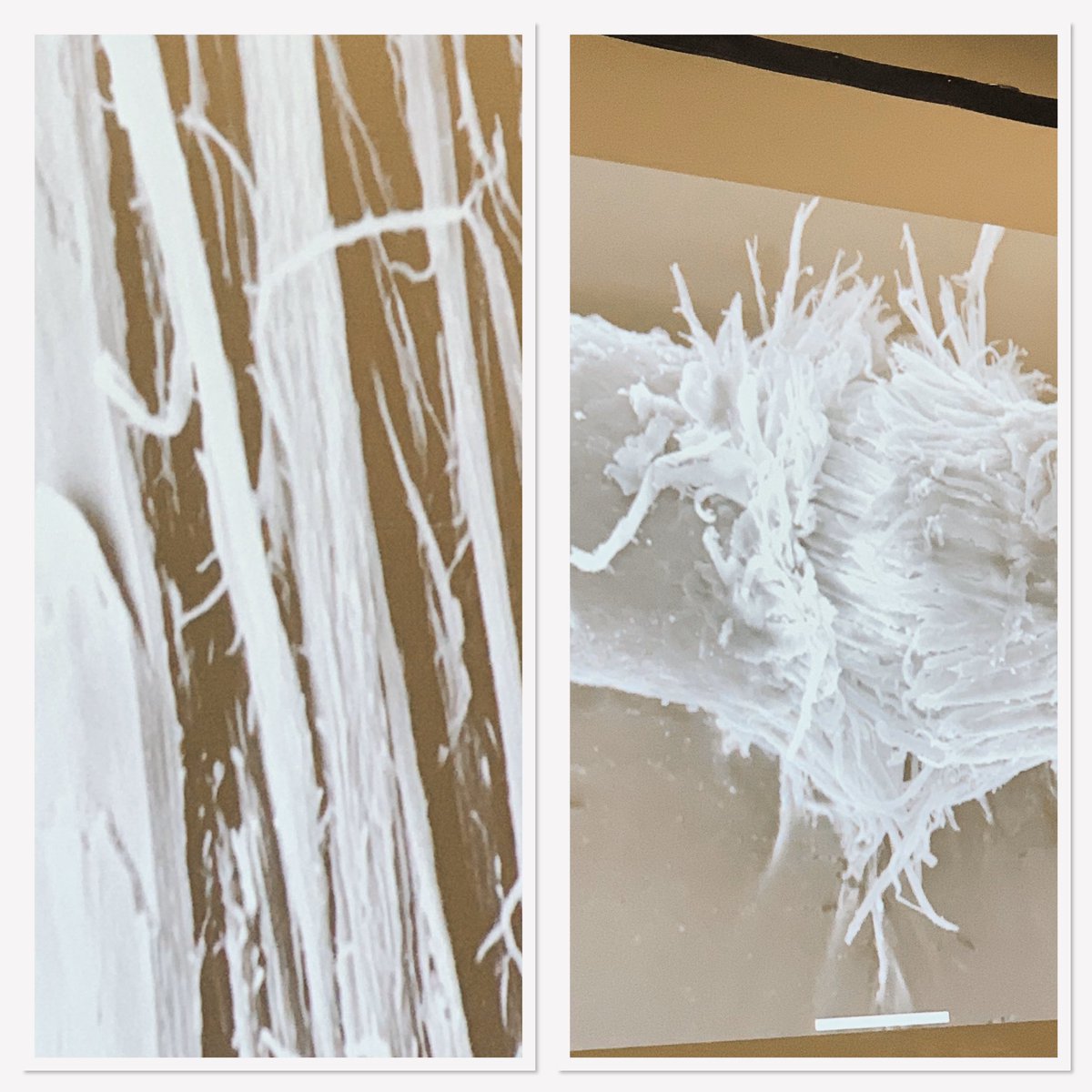 Fabulous lecture <a href="/bahrs/">Barry Greene</a> meeting afternoon session from <a href="/TonyMaleedy/">Tony Maleedy</a> on causes of hair damage and trauma, and some of the solutions we have <a href="/AestheticMLive/">Aesthetic Med Live</a>