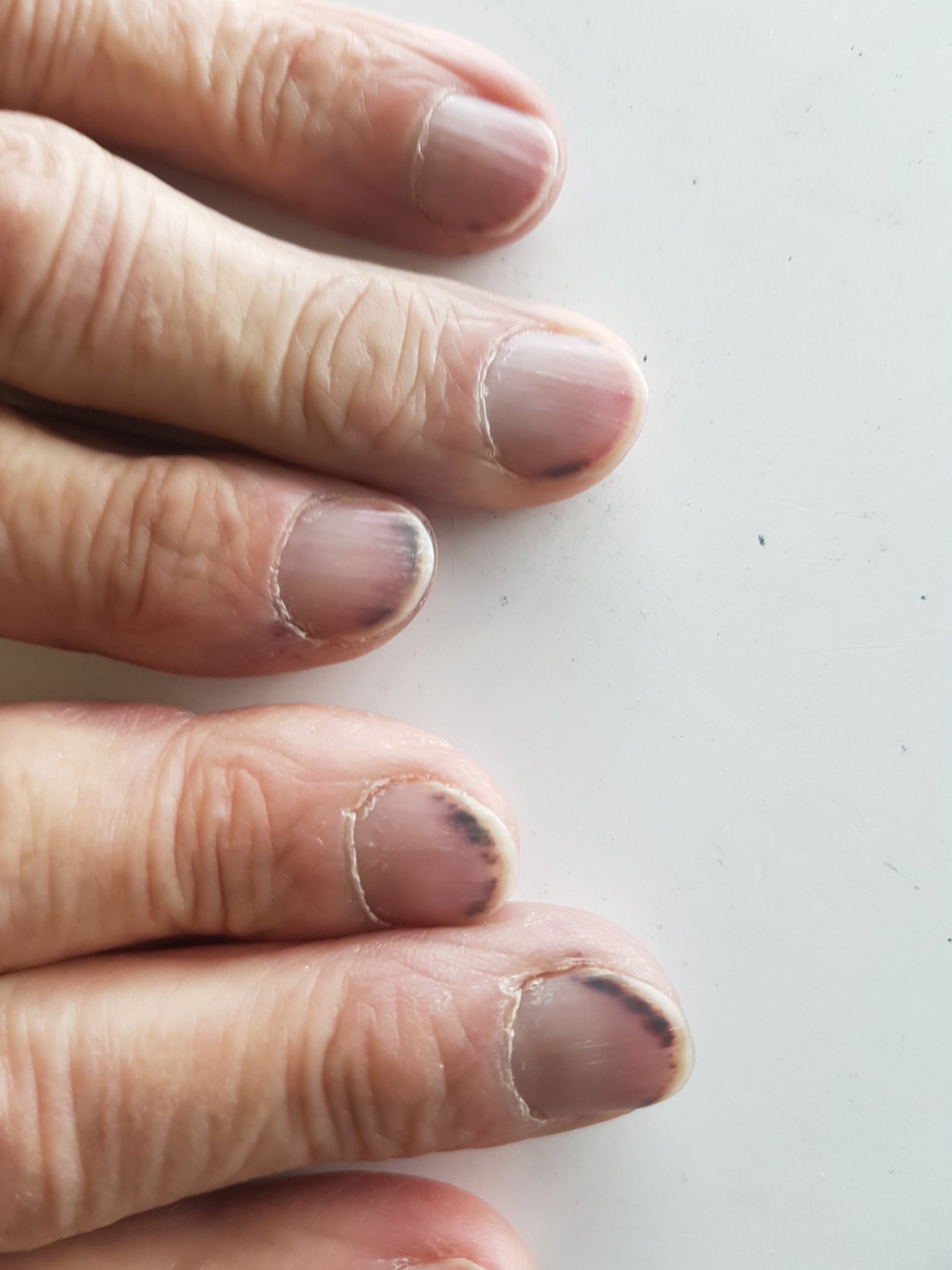 Reason For Black Lines on Nails, According to Manicurist | POPSUGAR Beauty  UK