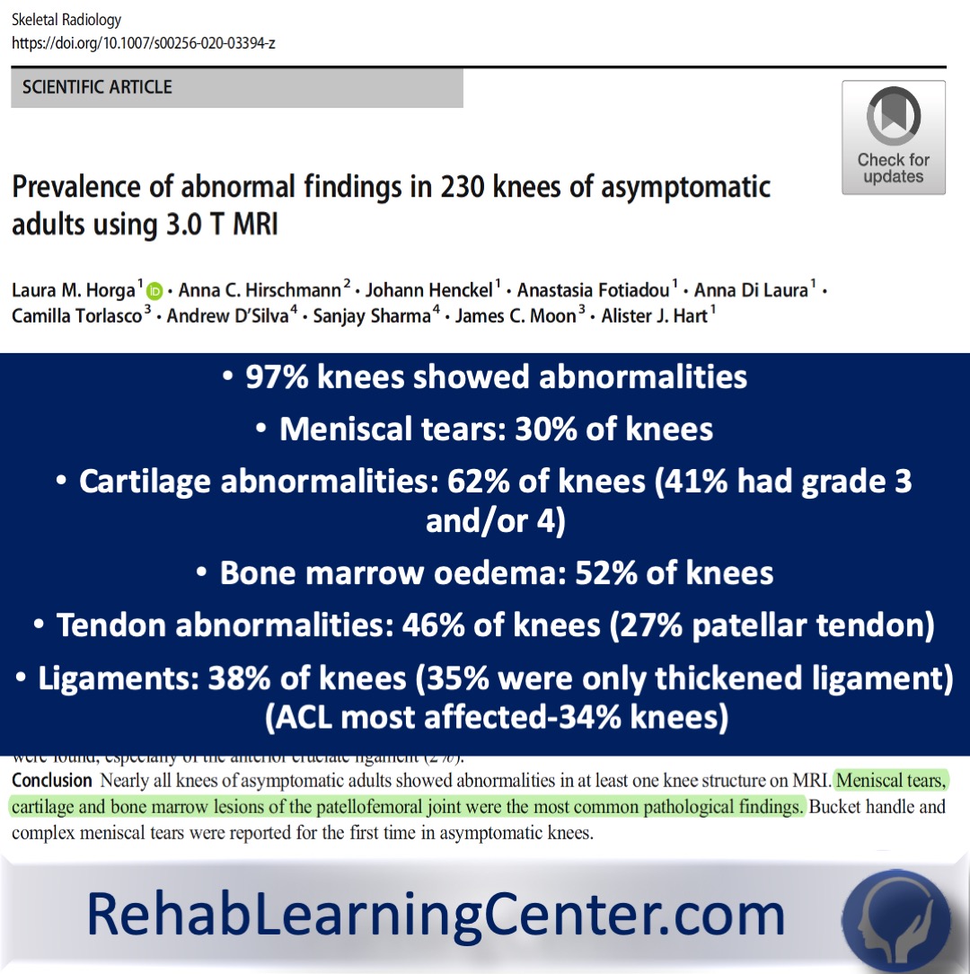 97% of asymptomatic knees had 'abnormality' on MRI. 115 sedentary adults. 78% were 40 or older, median age 44 years (range 25-73). Mean KOOS was 90 or greater all items. Meniscal tears, cartilage &amp; bone marrow lesions of PF joint most common.