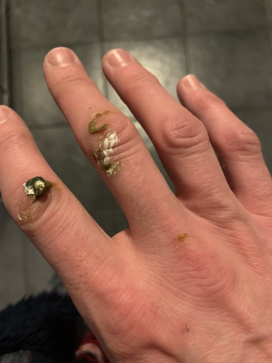 sidTHEparrot's tweet photo. When she’s fresh out the shower 🚿 walks down the stairs where iv been sitting and without knowing wipes her hand clean across my fresh shit! 💩😂🙌🏻🤪 #Gutted #sidslife #itslife #livingwithabirb #funnyshit #thisismyhousenow #shittyhand https://t.co/goGhWt3Nbp