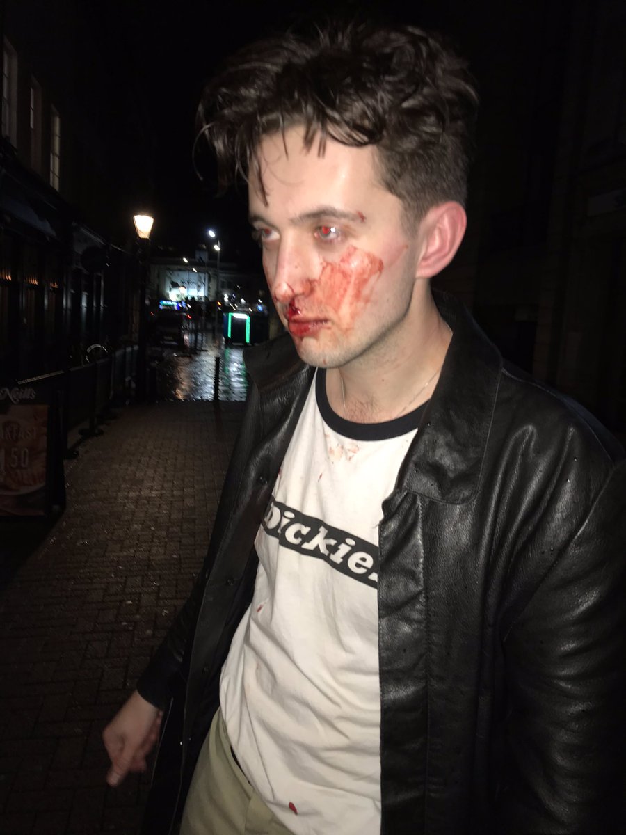 WhoAreBandicoot's tweet image. Imagine being beaten up for being Welsh #brexit