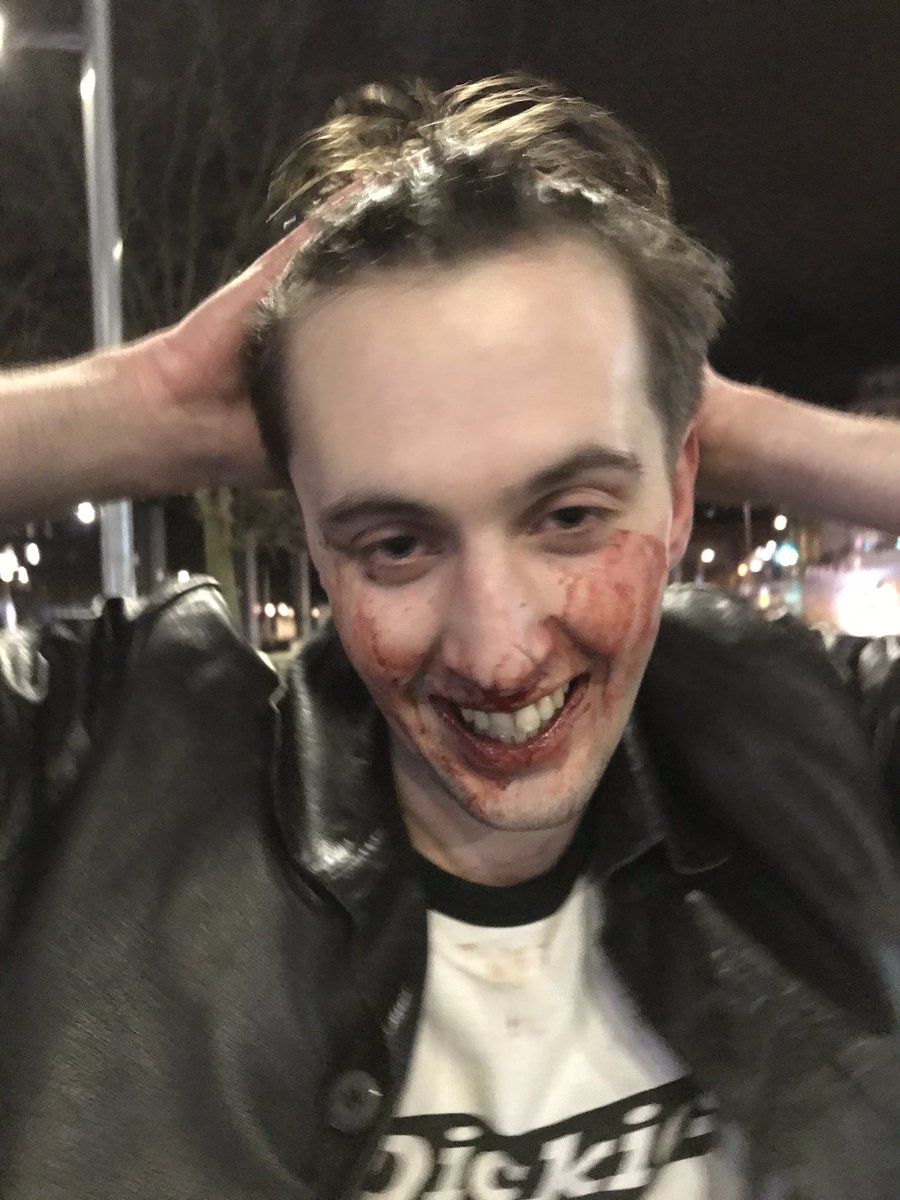 WhoAreBandicoot's tweet image. Imagine being beaten up for being Welsh #brexit