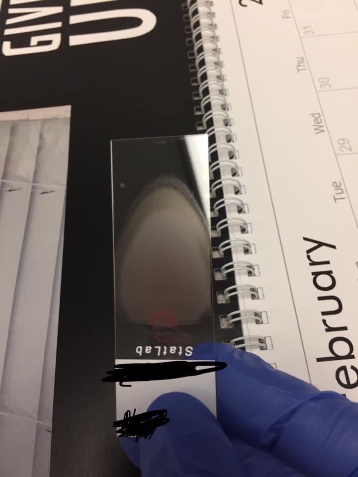 McDonald47's tweet photo. This is the best smear I made in my life. 

I was running around showing it🤪🤪🤪
#labporn https://t.co/IG746xYu7b