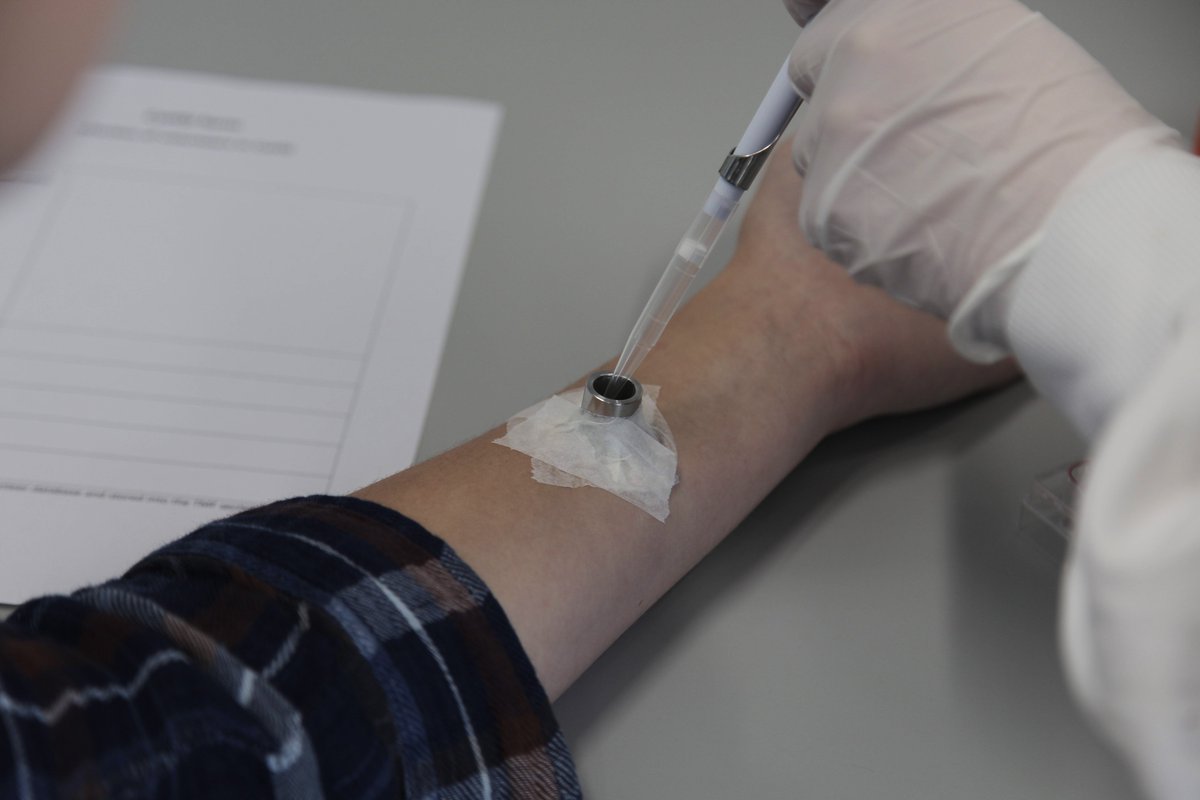 17 gezonde vrijwilligers zijn in Leiden bewust geïnfecteerd met de parasitaire worm #schistosoma. Waarom zou je dat doen? Lees het hier: bit.ly/2VbYsaD

#vaccinonderzoek #infectieziekten #worminfectie