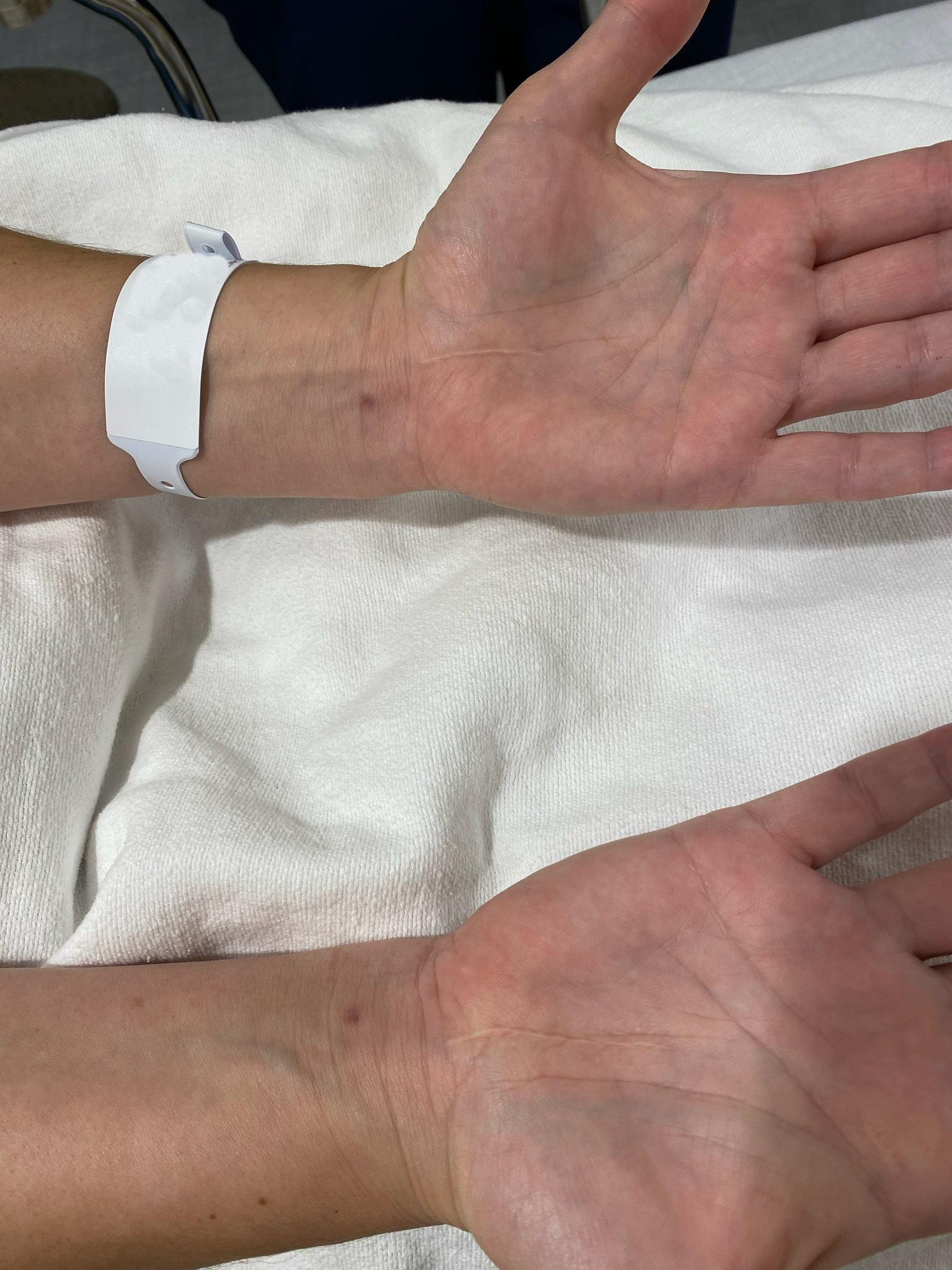 Very small wrist sales