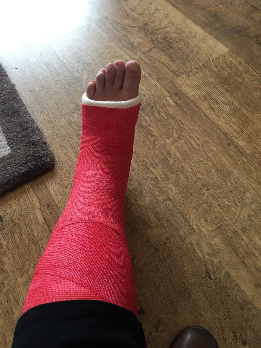 annieel23708796's tweet photo. 1 - stitches out 2 - see consultant and X-ray of scaffolding holding leg together 3 - new boot π’ for next 3 weeks π§. Tarn colours β€οΈ #gutted #poorlyleg #barnsleyfc #fedup xxxxx https://t.co/lVfAkX13NS