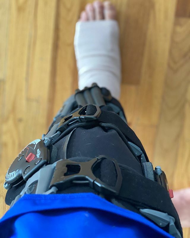 So yesterday I came out of theatre after having surgery to replace a torn ACL and clean up a torn meniscus.
•
Despite being in love playing the beautiful game, it does have its downfalls, as I found on New Year’s Eve when I went in for 50/50 tackle a… ift.tt/2STET42