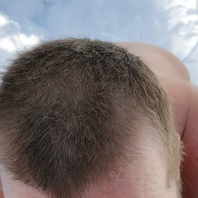 My blond hair is finally growing back.  I've had a lot of questions about it lately.  I had my head shave<a href="/tag/newprofilepic"class="tags"><span>#newprofilepic</span></a>