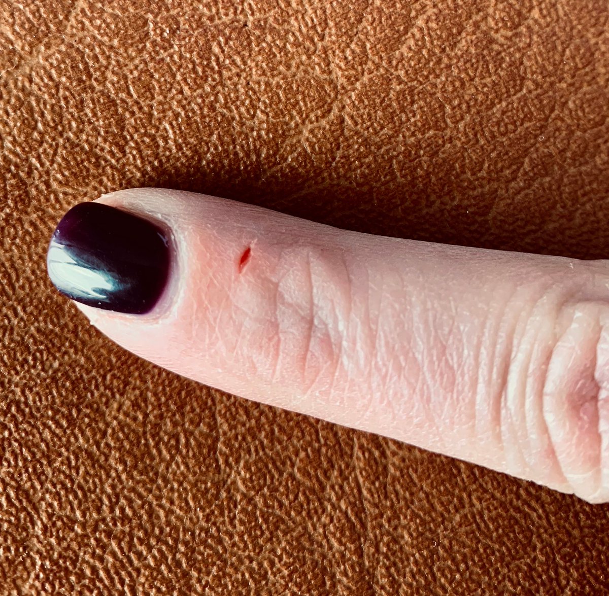 Finger with paper cut