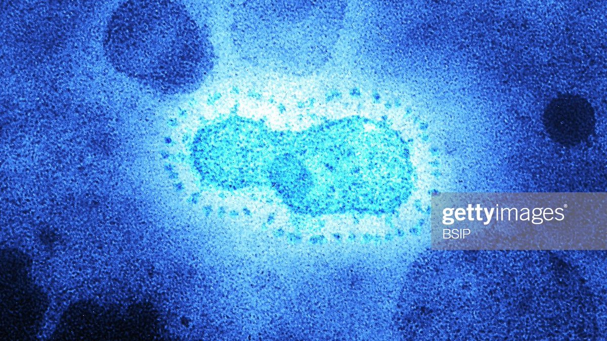 CORONA_VIRUSThe Crown Shape Of This Virus Gives Its Name:CoronovirusThe Crown Encircles The Viral Capside A Protein Structure Protecting The Viral Nucleic Acid.