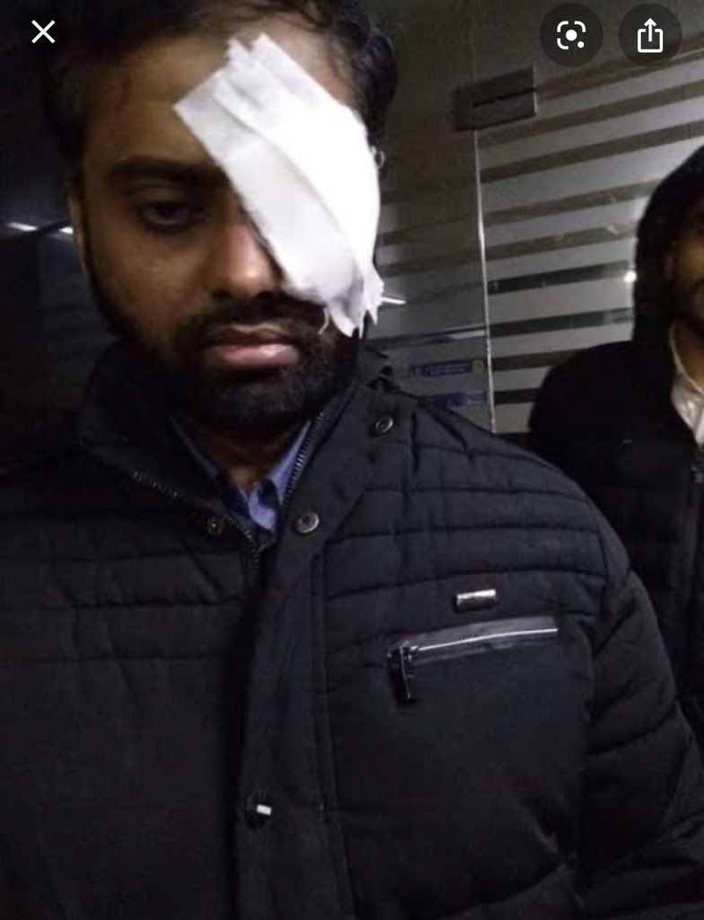 im_KaunainRaza's tweet photo. Minhajuddin who lost his eye in the brutal attack by the DP on 15 Dec in Jamia Library has just won the best paper award at the JTA Conference 2020. He got a standing ovation..
He was writing the paper for same conference when he was attacked. #JamiaViolence
#JamiaUnderAttack https://t.co/jSLGULD2q2