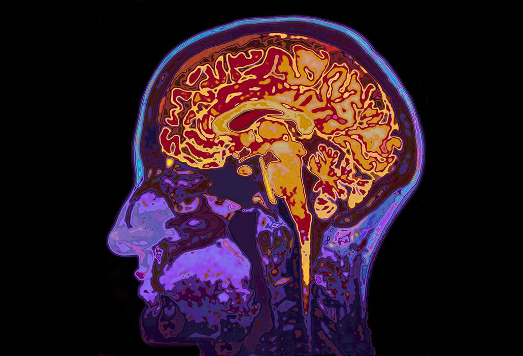 zebra_trans's tweet photo. Researchers at Cambridge Science Festival reveal latest insights into the brain via @UKLifescience 
https://t.co/VpDDLMpQEA 
#science #sciencefestival #brain #neurology #medxl8 #xl8 #research https://t.co/m8kMHguDrH