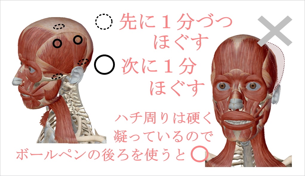 戸塚哲春 顔トレーニング 中目黒整体レメディオ ハチ張り 頭が大きい小さくする方法 当てはまる人 ハチが張る 頭が大きい 額が四角い 顔幅が大きい エラ張り 頭の横側にある側頭筋はストレスがかかると年々太くなり