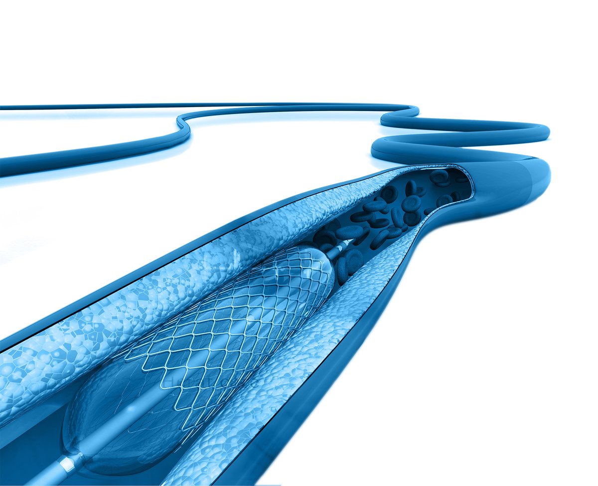 Tentamus's tweet photo. The new Medical Device Regulation will apply from 26 May 2020. Find out more about the new regulations & testing possibilities on our website: https://t.co/u0QuqXPz4o
#Tentamus #LabsForLife #medicaldevices #regulation #MDR #manufacturers #safety #invitro #testing #health https://t.co/4VDseKx1x9