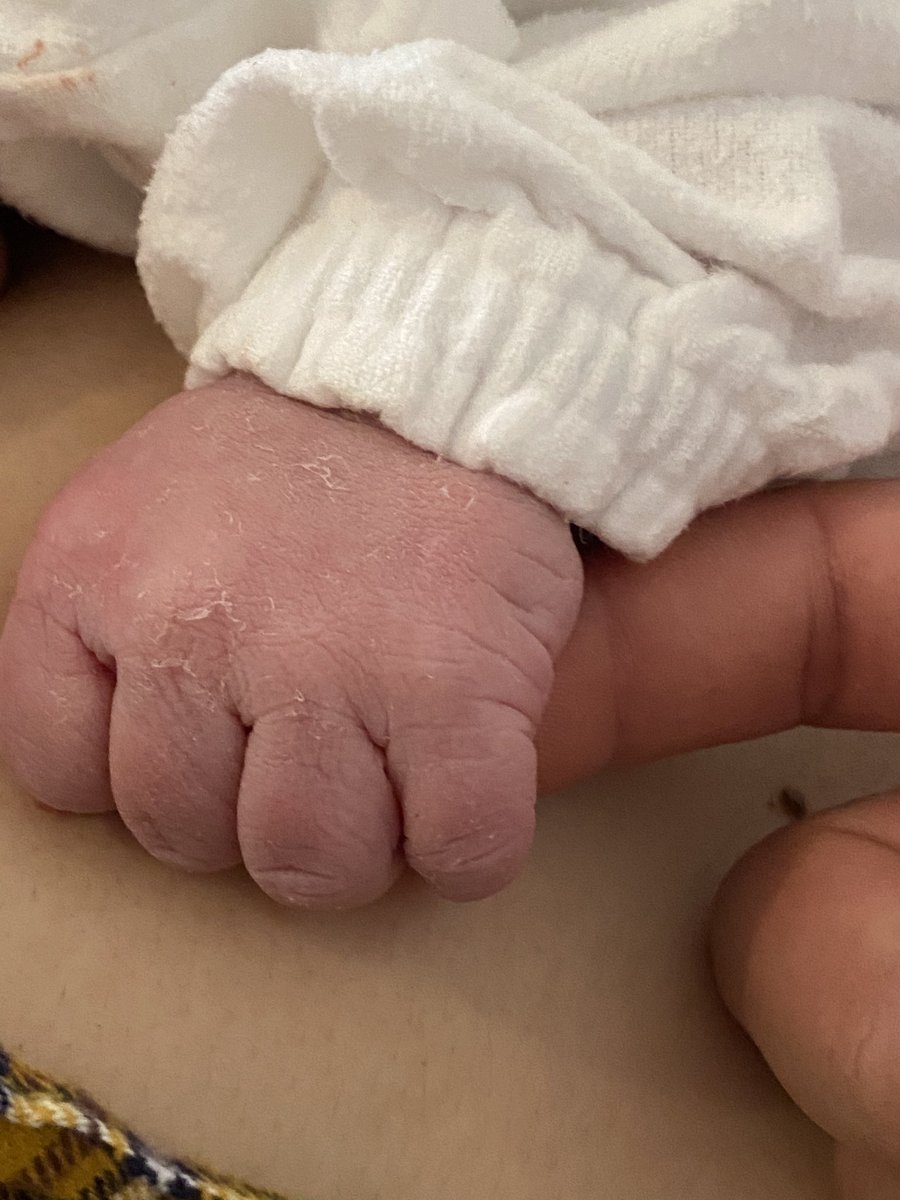 Mickey@黑手党 tweet media