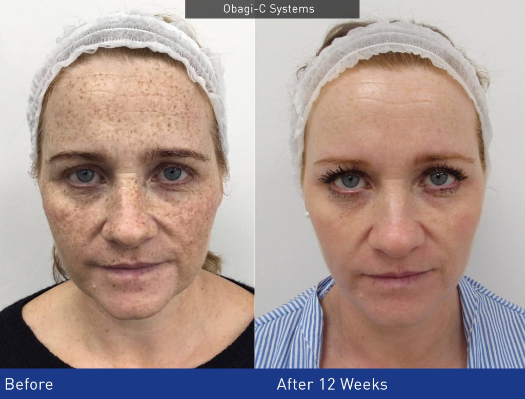 We know it's a little bit early yet, but a full skin analysis could be the perfect gift for Mother's Day.

We can use the Observ that we have in clinic to advise the best Obagi skin care systems to help protect and preserve skin, improving the appearance. bit.ly/3bygvgQ