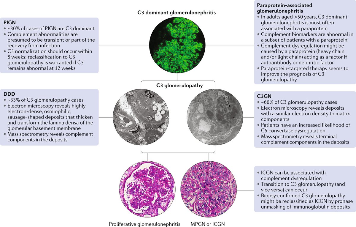 NatRevNeph's tweet photo. C3-dominant #glomerulonephritis. https://t.co/L0EqXvP2Oh https://t.co/YxEWIzA7xo